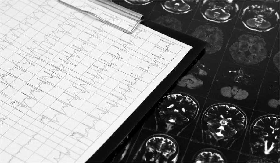 Daño Cerebral Adquirido como consecuencia de accidente de tráfico